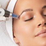 dermapen